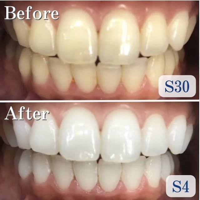 LBSホワイトニング新宿店（写真2）