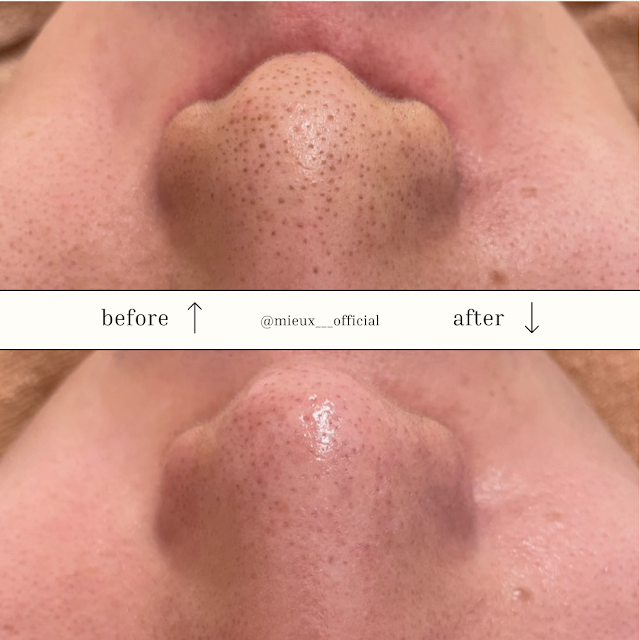 mieux 栄本店 ミュー（写真1）